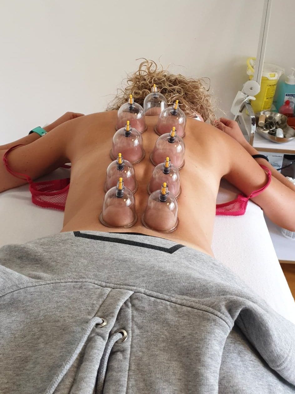 Cupping Massage Therapie
