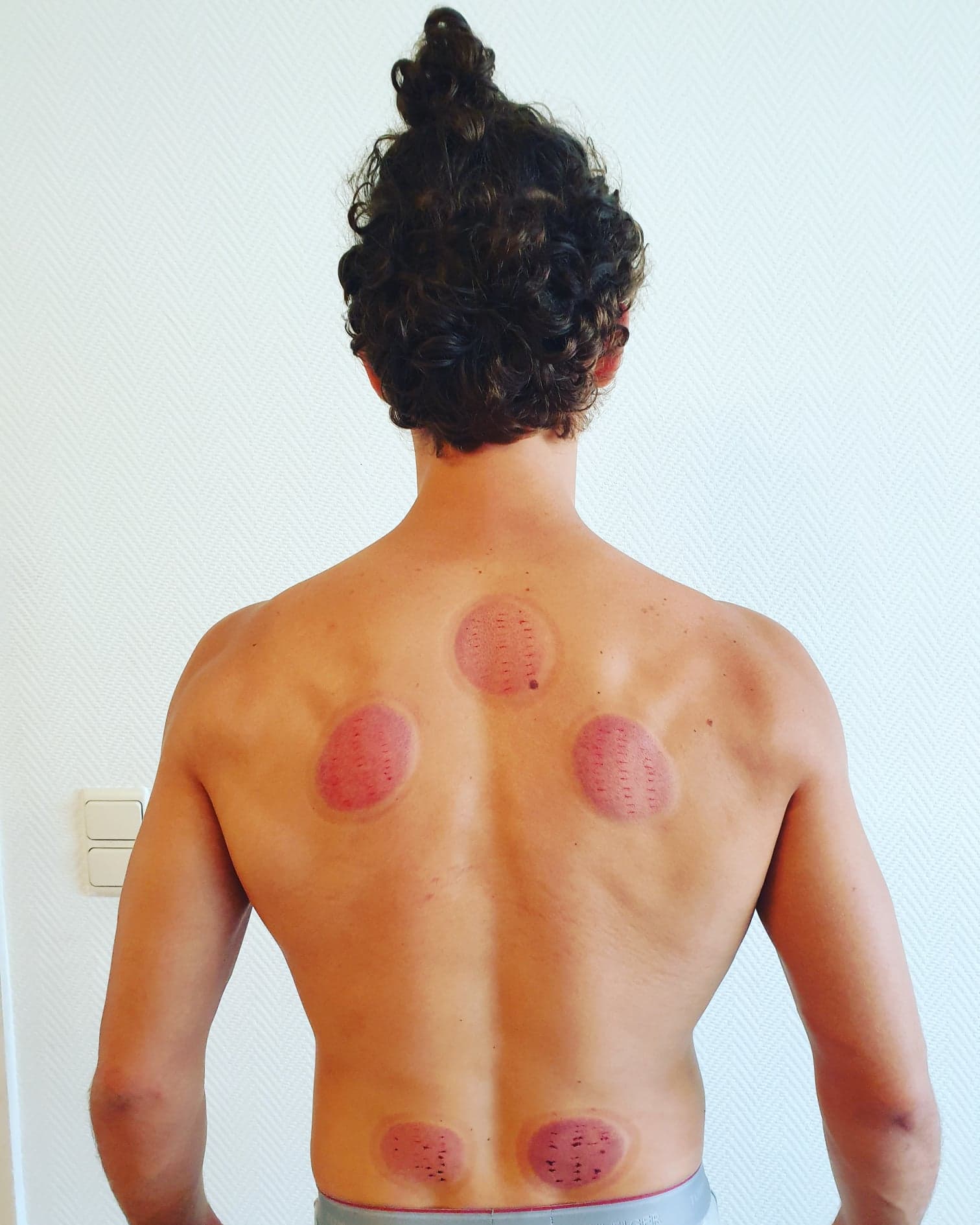Sportmassage & cupping therapie brugge